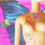 İİV+ olan trans Bakıda sinə implantı əməliyyatı ola bilmir: “Estetik cərrahlar iki qatı pul istəyir, əksəriyyəti isə yox cavabı verir”