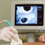 Rusiyada “aborta meylləndirmə” maddəsi ilə ilk cərimə