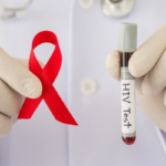 Səhiyyə Nazirliyindən açıqlama: Azərbaycanda 11 mindən çox İİV+lə yaşayan var